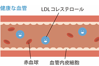 健康な血管